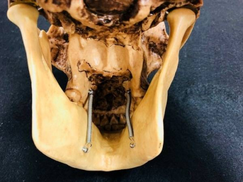 アウストラロピテクスのSOMSO MODELLE